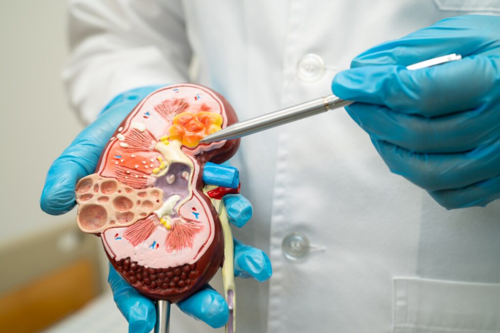 Kidney disease, Chronic kidney disease ckd, Doctor hold human model to treat and study in hospital.